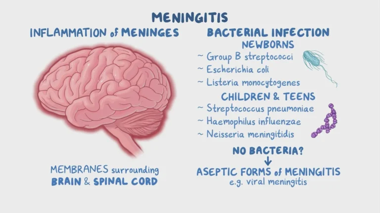 Meningitis: Its Causes, Symptoms, Diagnosis And Treatment Meningitis