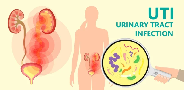 Urinary Tract Infections (UTI) : Its Types, Causes, Sign And Symptoms Explained Here Urinary Tract Infections