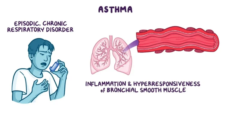 Asthma