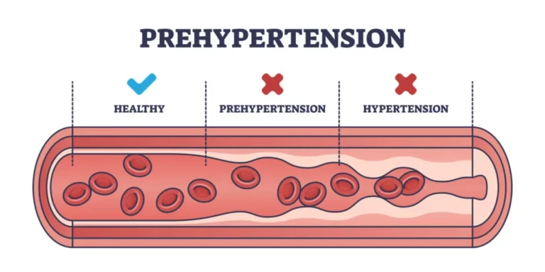 Hypertension