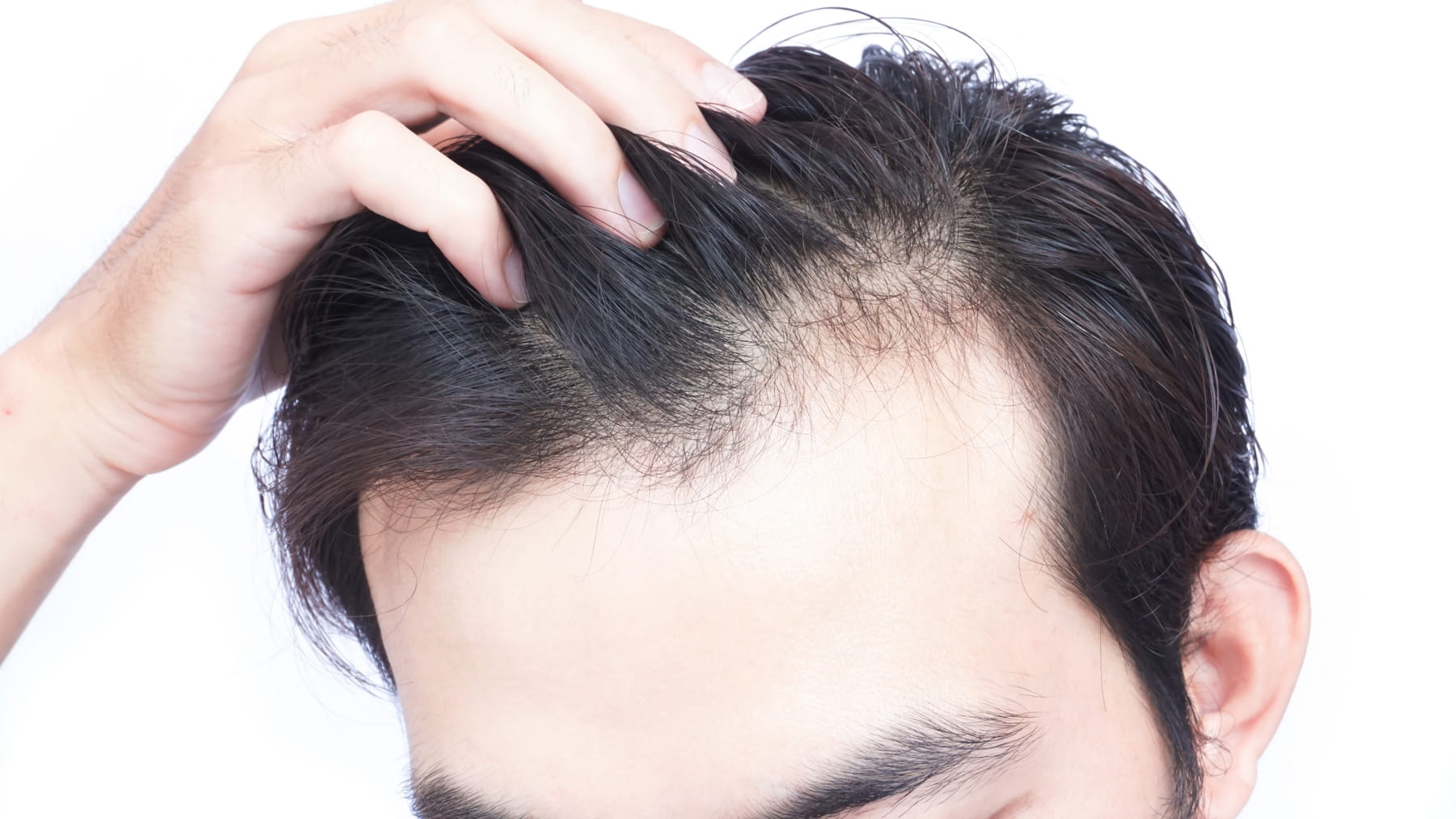 Hair-Loss-Prevention-Treatment